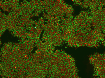 Induced Pluripotent Stem Cells stained for Nanog and TRA-1-60