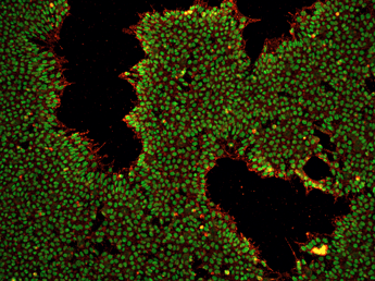 Induced Pluripotent stem cells stained for OCT4 and SSEA4 using ICC